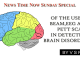 OF THE USE OF BEAM EEG AND PETT SCANS IN DETECTING BRAIN DISORDERS